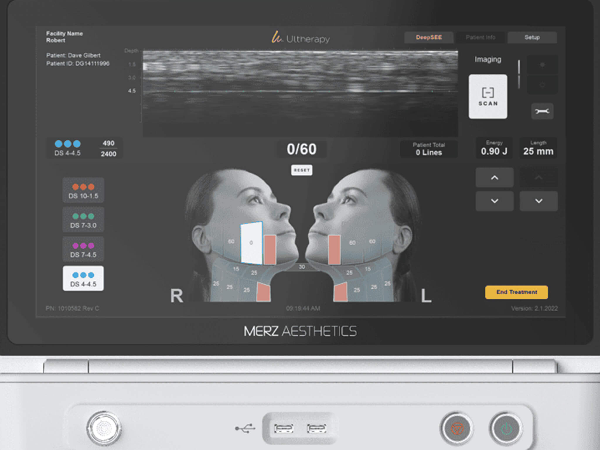 Image hover effect image